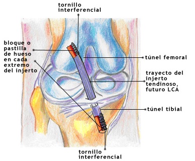 anatomia lca