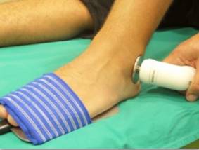 Fisioterapia del esguince de tobillo y su tratamiento Capacitiva y - Blog