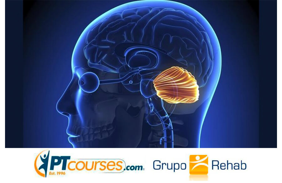 Accidente Cerebrovascular Cerebeloso ¿Qué lo hace diferente? Accidente Cerebrovascular Cerebeloso ¿Qué lo hace diferente?