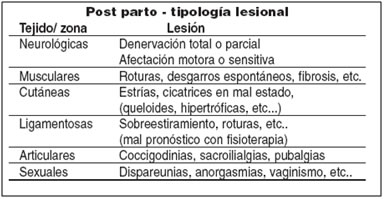 posturas en el parto