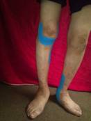 taping neuromuscular en artritis