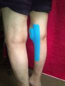 taping neuromuscular en artritis