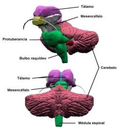 Arnold Chiari