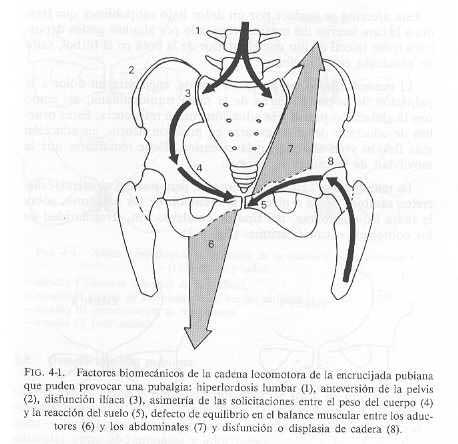 Osteopatía dinámica de pubis