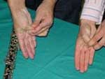 Fisioterapia del arte