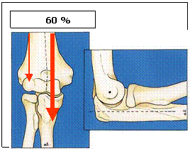 lesiones ligamentosas del codo