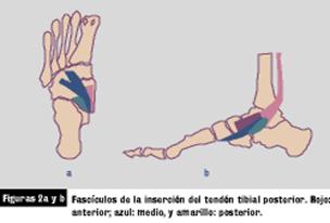 Fisioterapia pie plano