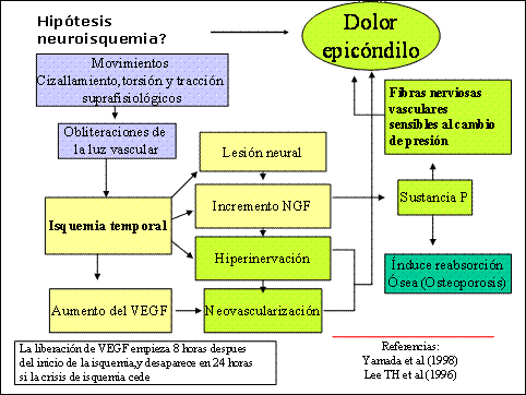 Epicondilitis o epicondilosis