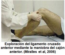 ejercicios en pacientes con lesión de LCA
