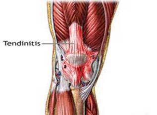 Biomecánica articulación rodilla