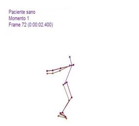 Biomecánica articulación glenohumeral