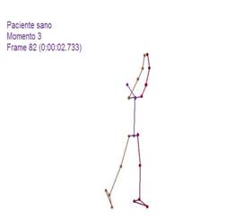 Biomecánica articulación glenohumeral