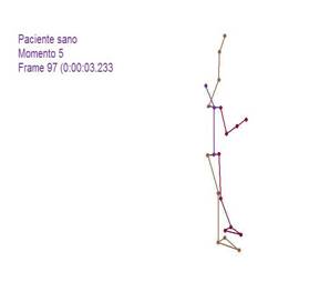 Biomecánica articulación glenohumeral