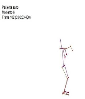 Biomecánica articulación glenohumeral