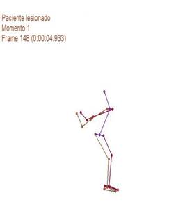 Biomecánica articulación glenohumeral