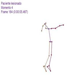 Biomecánica articulación glenohumeral