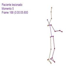 Biomecánica articulación glenohumeral