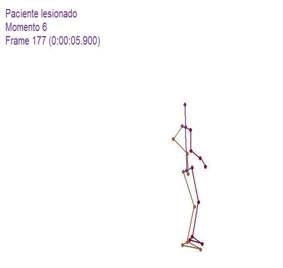 Biomecánica articulación glenohumeral