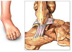 articulación tibiotarsiana