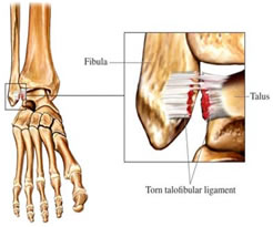 articulación tibiotarsiana