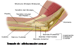 epicondilitis lateral