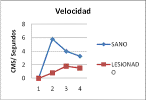 epicondilitis lateral