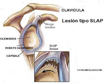 terapia manual neuro-ortopédica