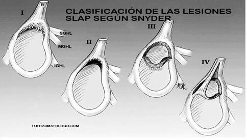 terapia manual neuro-ortopédica