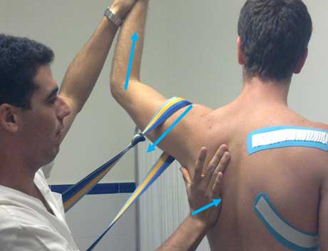 terapia manual neuro-ortopédica