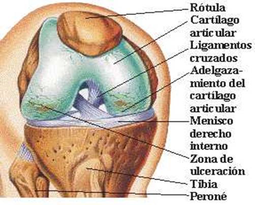 tratamentul articular la Myrgorod