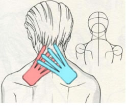 bandagem para cervicalgia Aplicaciones del vendaje neuromuscular en las cervicalgias.