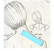 Aplicaciones del vendaje neuromuscular en las cervicalgias.