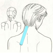 Aplicaciones del vendaje neuromuscular en las cervicalgias.