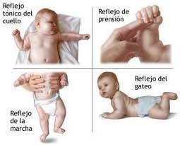 evaluación neuromotriz en pediatría