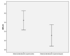 Ejercicio en espondilitis anquilosante