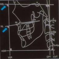 entrenamiento cervico-mandibular