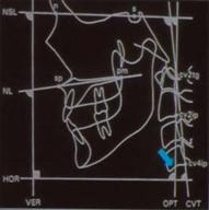 entrenamiento cervico-mandibular