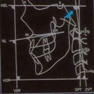 entrenamiento cervico-mandibular