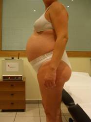 lumbalgia en la mujer embarazada
