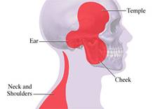 Alteraciones de la articulación temporomandibular