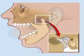 Alteraciones de la articulación temporomandibular