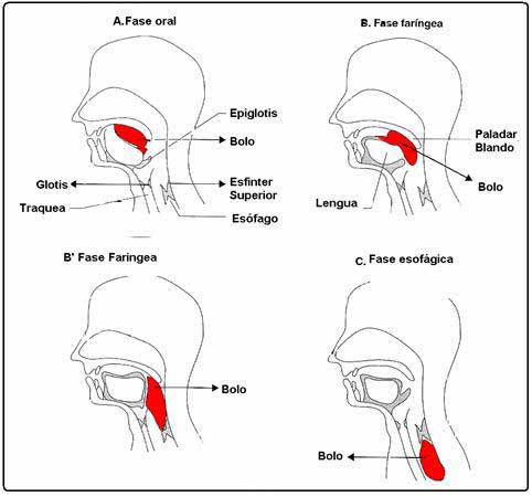 Trastornos de la deglución