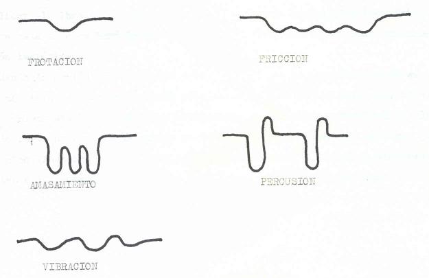 fisioterapia en la hemiplejía