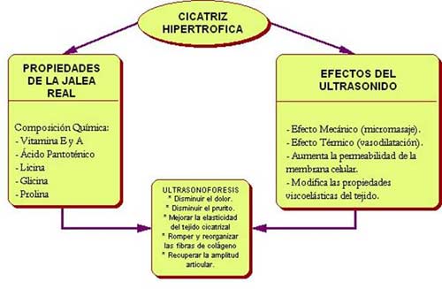 ultrasonoforesis cicatriz hipertrófica