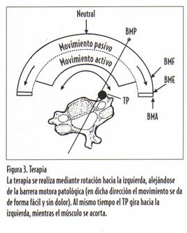 lesión osteopática