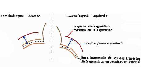 fisioterapia respiratoria