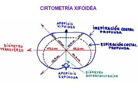 fisioterapia respiratoria