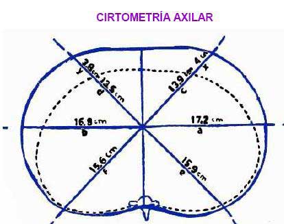 fisioterapia respiratoria