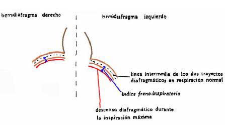 fisioterapia respiratoria