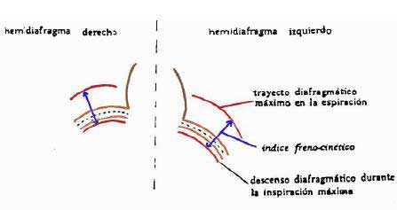 fisioterapia respiratoria